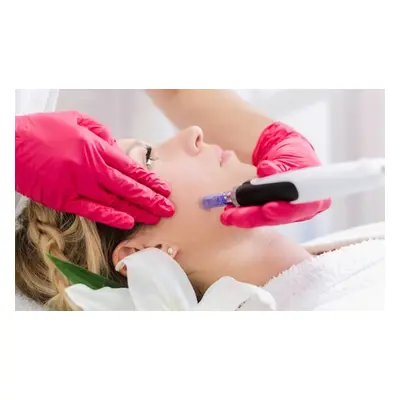 Delux microneedling session with vitamin infusion (One Session)